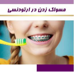 مسواک زدن در ارتودنسی