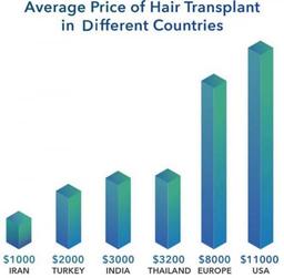 Hair transplant in Iran