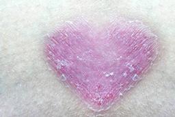 راهنمای تصویری پسوریازیس