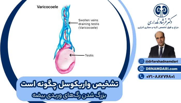 مانور والسالوا در بیضه چیست؟ + مانور والسالوا در سونوگرافی 
