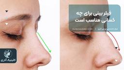 فیلر بینی برای چه کسانی مناسب است