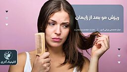 ریزش مو بعد از زایمان