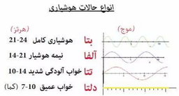 آموزش ریلکسیشن هربرت بنسون به زبان ساده : دریچه ای به ناخوداگاه