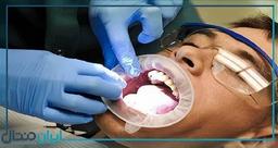 توصیه های مراقبتی بهترین دکتر پروتز فک ⭐️【سال1403】✅