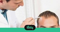 وظایف بهترین دکتر کاشت مو در تهران