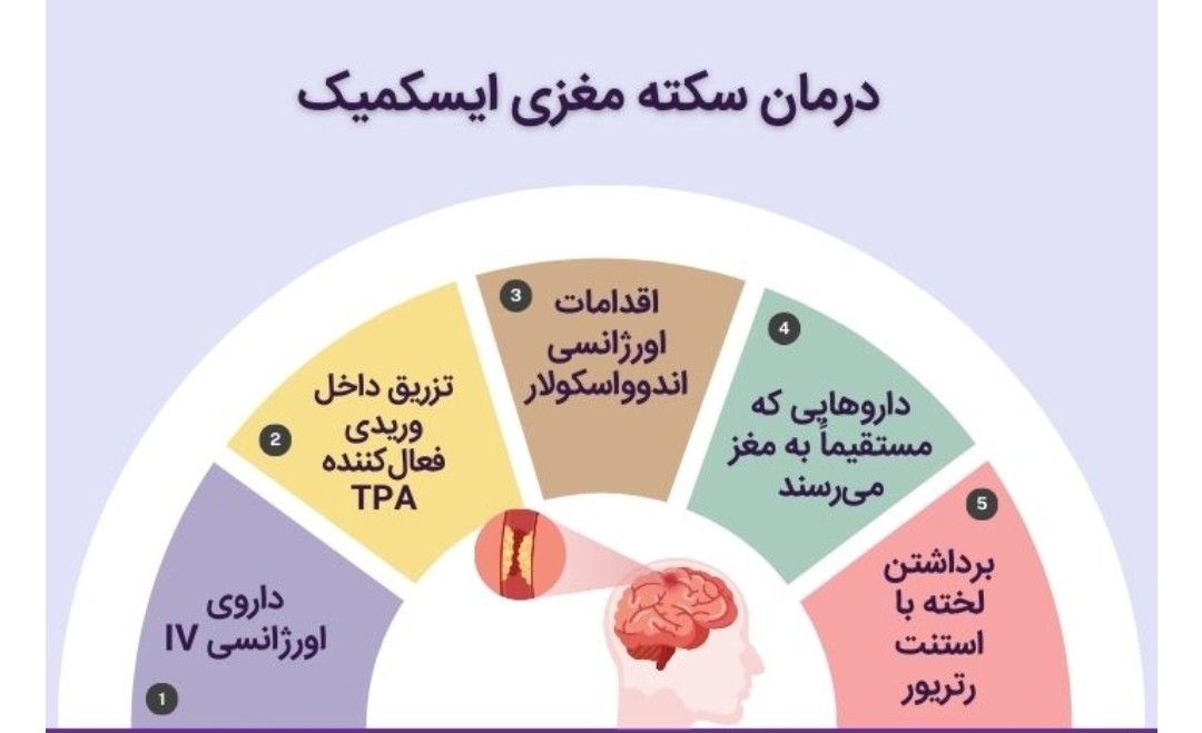 نگین سلامت - سکته مغزی 