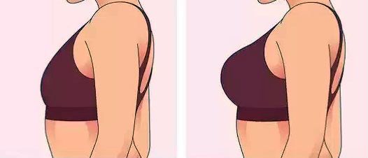 جراحی زیبایی سینه