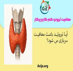 کم کاری تیروئید باعث معافیت سربازی میشود