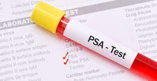 چطور تست اعتیادم را منفی کنم؟