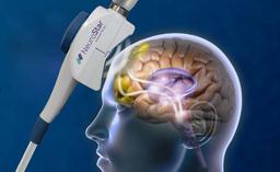 درمان افسردگی با تی ام اس