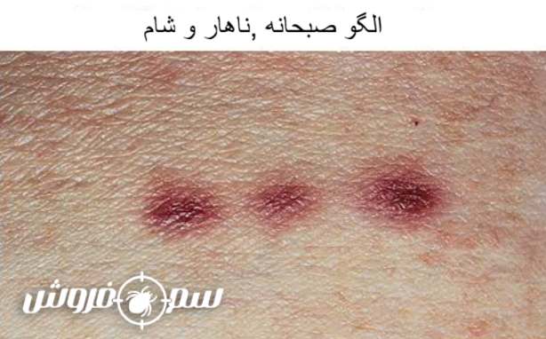 الگوی صبحانه، ناهار، شام در گزش کلاسیک ساس (الگوی خطی)