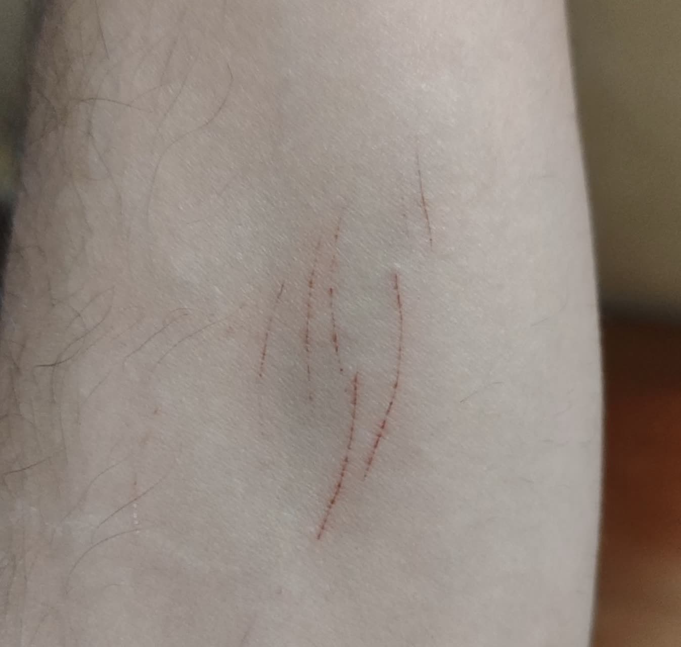 شبیه شعله آتش شده بنظرم :)