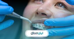 دکتر ارتودنسی در کرج