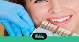 بهترین دکتر لمینت در شیراز