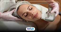ماندگاری هایفوتراپی چقدر است؟
