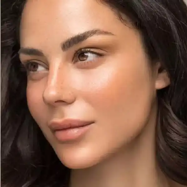 بوکال فت غبغب یک روش جراحی زیبایی است که چربیهای اضافی ناشی از چاقی، ژنتیک، افزایش سن یا هر مورد دیگر را تخلیه نموده و جهت بهبود شکل و ظاهر صورت به مناطق دیگر مانند خط لبان، عمق پوست و صورت تزریق میشود.