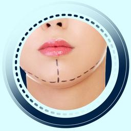 انواع پروتز چانه