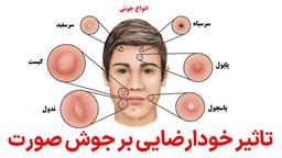 آیا خودارضایی باعث ایجاد جوش میشه ؟