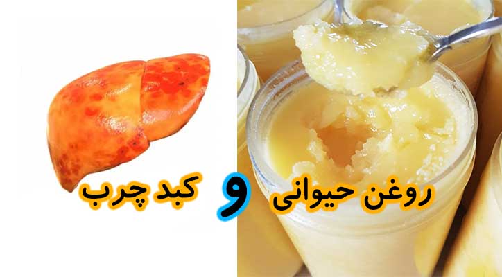 ارتباط چربی حیوانی با بیماری کبد چرب
