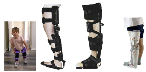 شکل 3-ارتز های کافو با قفل زانو یا با لولای آزاد یا تنظیمشونده