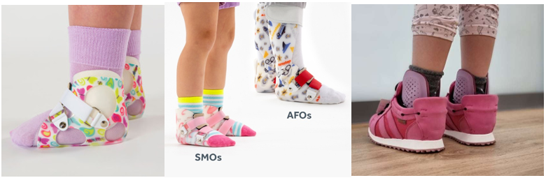 شکل 4-ارتزهای SMO یا ارتز قوزک و مچ پا