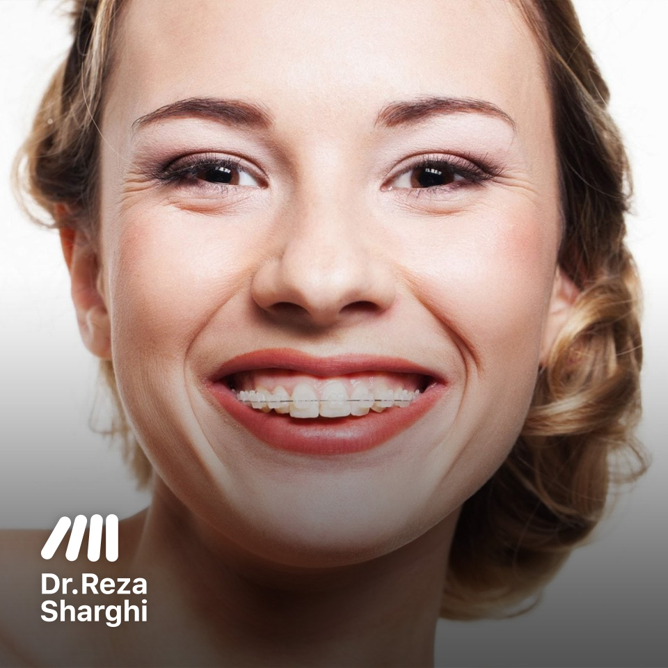ارتودنسی رنگ دندانی