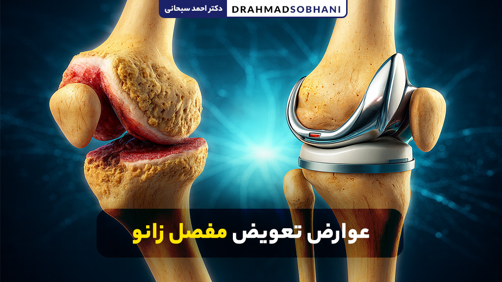 عوارض تعویض مفصل زانو