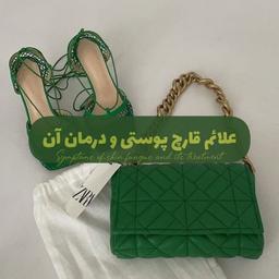 علائم قارچ پوستی و درمان آن