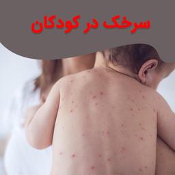 آشنایی کامل با سرخک کودکان