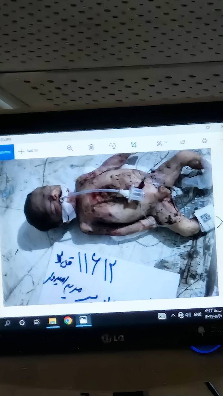 از مانیتور پزشکی قانونیِ کهریزک تهران.