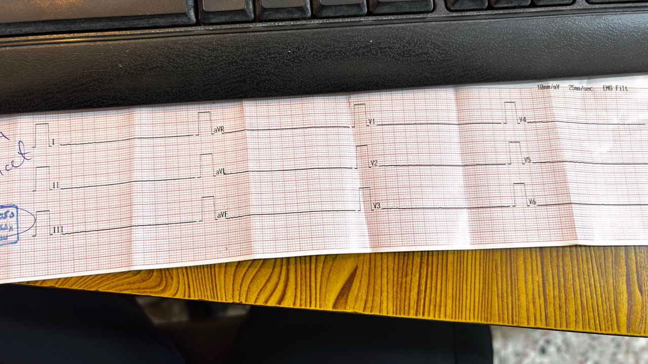 Flat ECG - آخرین چیزی که توی پرونده‌ی هر کدوممون می‌خوان، البته مال این دنیاش اگر دنیای دیگه‌ای در کار باشه یا نباشه! نمی‌دونم!