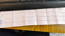 تکه‌پاره‌های ازدست‌رفته‌ی روحِ من.