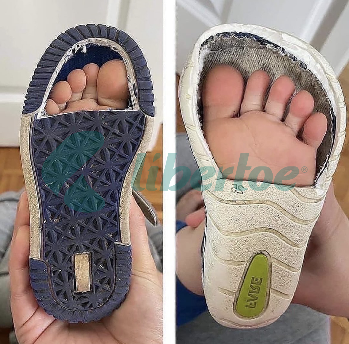 مقایسه فرم پای کودک در کفش معمولی و کفش سلامت!
