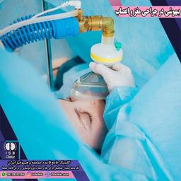 بیهوشی بعد از عمل سکته مغزی