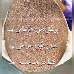 کلینیک پیله