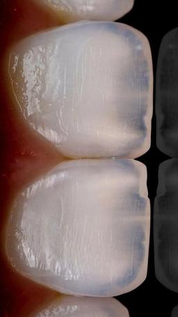 استعداد تاریک بودن