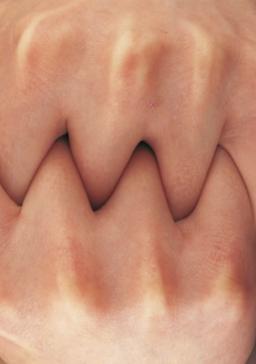 سلام بر درختان تن لش