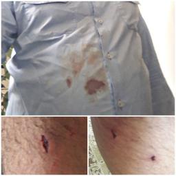 زخمی؟ یا بی‌حال؟ یا هر دو؟!