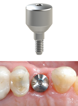 ارائه کیفیت کاشت ایمپلنت دندان در کلینیک دندانپزشکی آدرینا