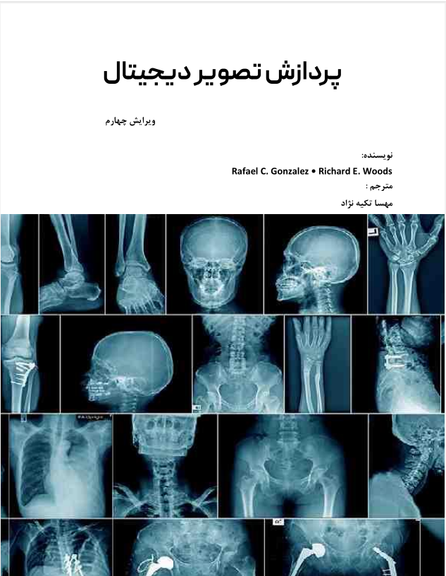 دانلود کتاب پردازش تصویر دیجیتال گنزالس ترجمه فارسی (ویرایش جدید )