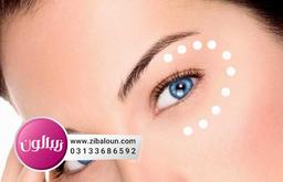 علت چین و چروک اطراف چشم چیست؟