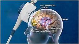 درمان سردرد میگرنی