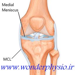 پروسه فیزیوتراپی و توانبخشی پس از اسیب لیگامان طرفی داخلی در زانو