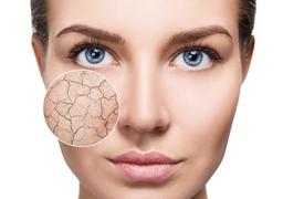 خشکی پوست؛ نشانه‌ها، دلایل و پیامدها