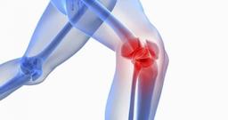 درد زانو در دوران بارداری