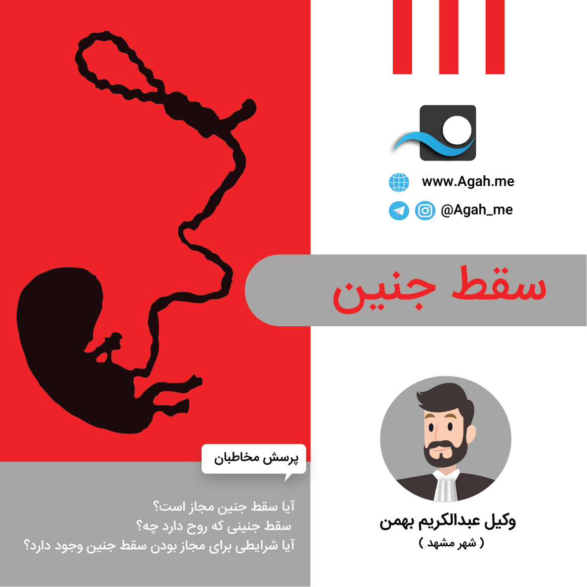 سقط جنین ویرگول