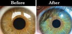 تغییر رنگ چشم با 2 روش طبیعی و ساده
