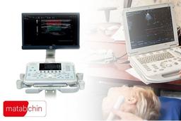 همه چیز درباره دستگاه TCCD