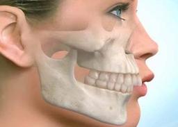 جراحی ژنیوپلاستی یا جراحی فک و چانه