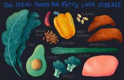 نشانه‌های کبد چرب